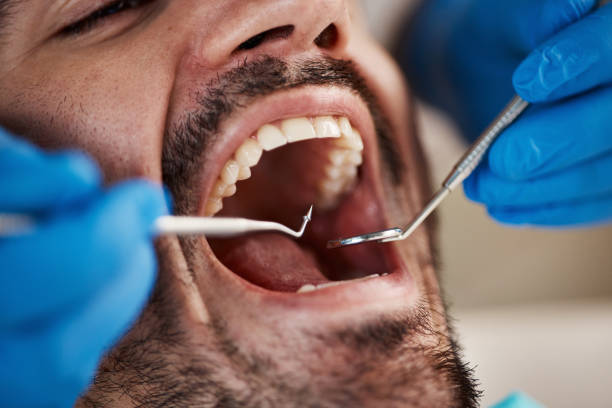 Professional Emergency Dentist in MT