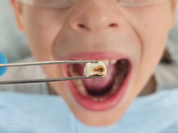 Best Tooth Infection Emergency Dentist  in North Browning, MT
